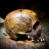 Human skull
