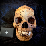 Item 4. Human skull with mandible