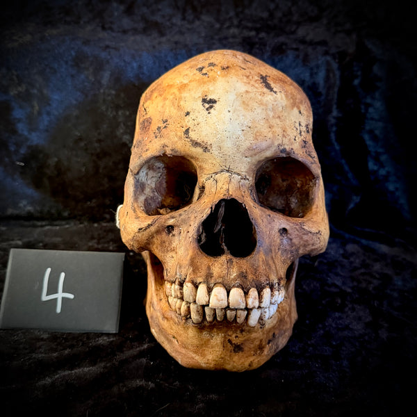 Item 4. Human skull with mandible