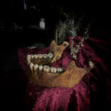 A mandible