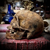 Human skull