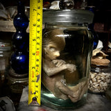 Fetal specimen