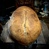 Human skull
