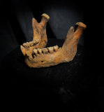A mandible