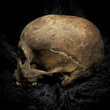 Human skull