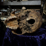 Human skull
