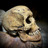 Human skull with mandible