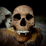 Human skull with mandible