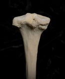 Human tibia (shinbone)