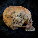 Item 15. Human skull