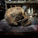 Human skull