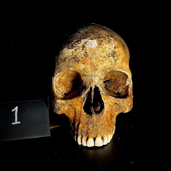 Item 1. Human skull