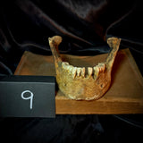Item 9. Human mandible