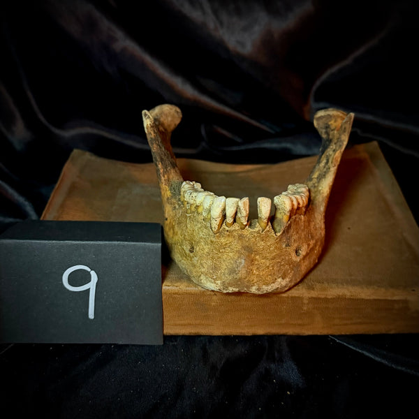 Item 9. Human mandible