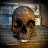 Human skull