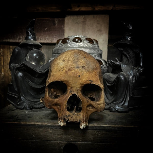 Human skull
