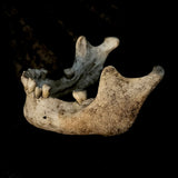 A mandible