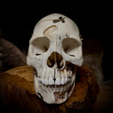 Medically prepared human skull