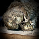 Human skull with mandible