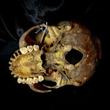 Item 18. Human skull