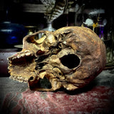 Human skull