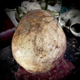 Human skull