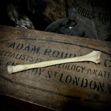 Human radius bone