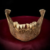 A mandible