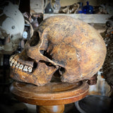 Human skull with mandible