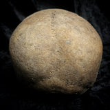 Human skull