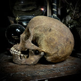 Human skull with mandible