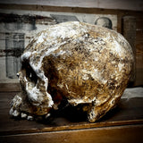Human skull
