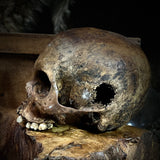 Human skull (bone cancer)