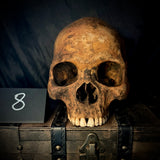 Item 8. Human skull