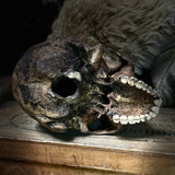 Human skull