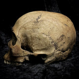 Human skull
