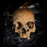 Human skull