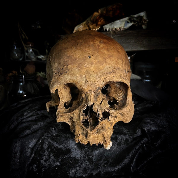 Human skull