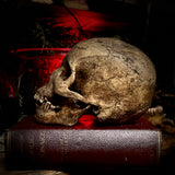 A human skull with mandible