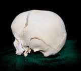 Child dwarf skull