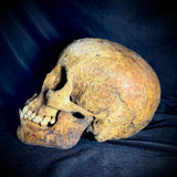 Item 1. Human skull with mandible
