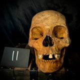 Item 11. Human skull with mandible