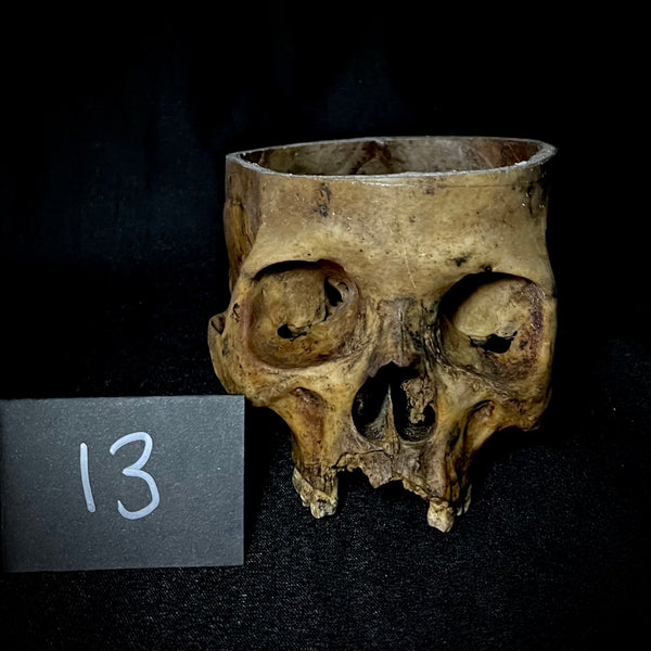 Item 13. Partial human skull