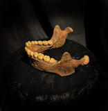 A mandible