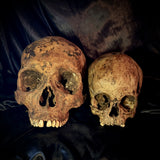 Item 3. Child skull