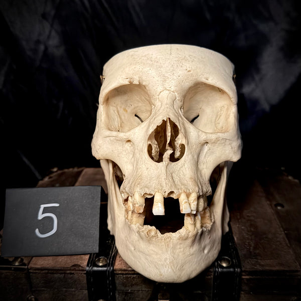 Item 5. Human medical skull