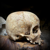 Human skull