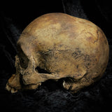 Human skull