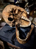 Human skull