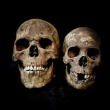 Extremely large Human skull with mandible